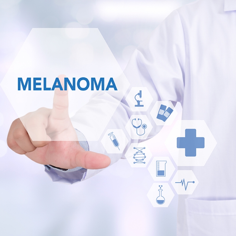 Melanoma doctor stock photo.